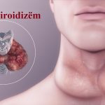 hipotiroidizem
