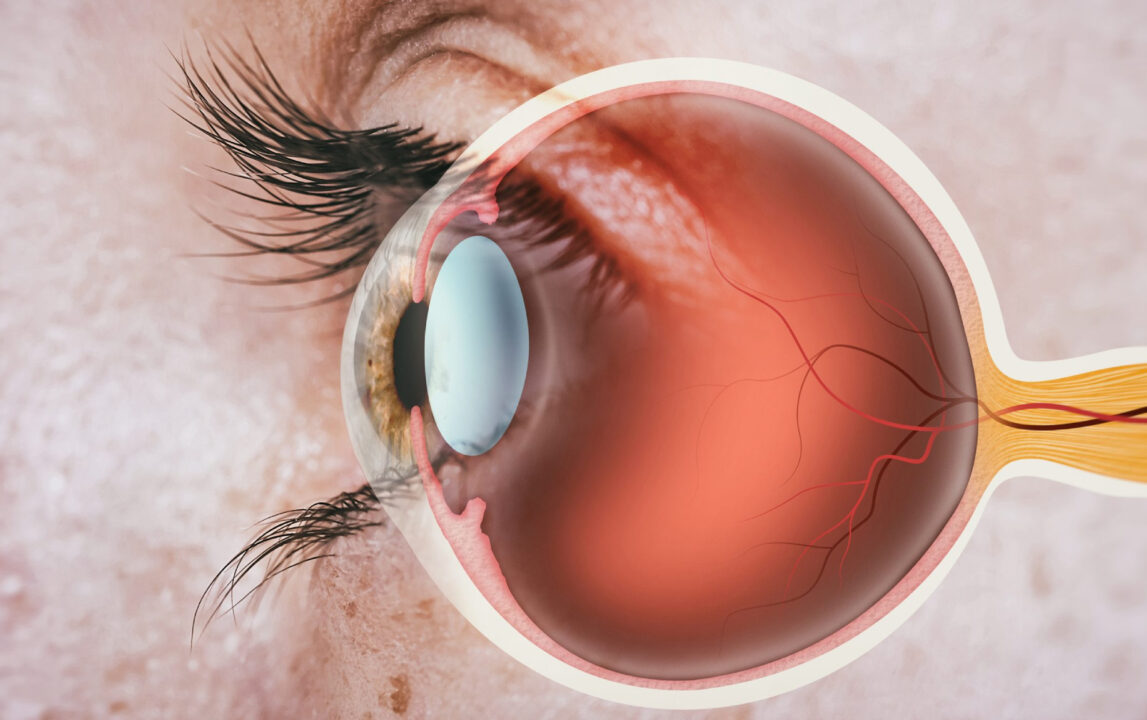 Trajtoni dhimbjet e syve me metoda natyrale në shtëpi