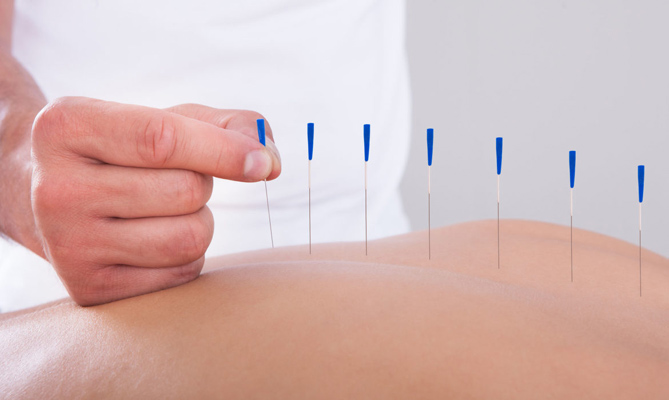 A mund të lehtësojë akupunktura dhimbjet e kyçeve?