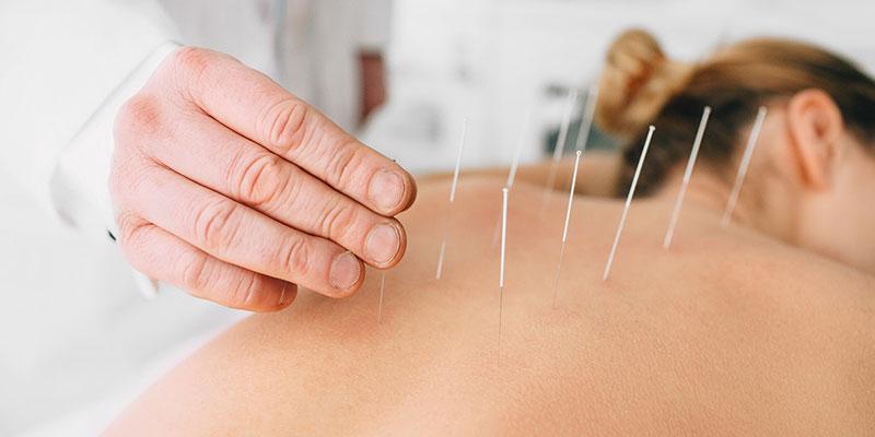 Akupunktura/ Cilat janë përfitimet e kësaj procedure?